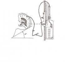351